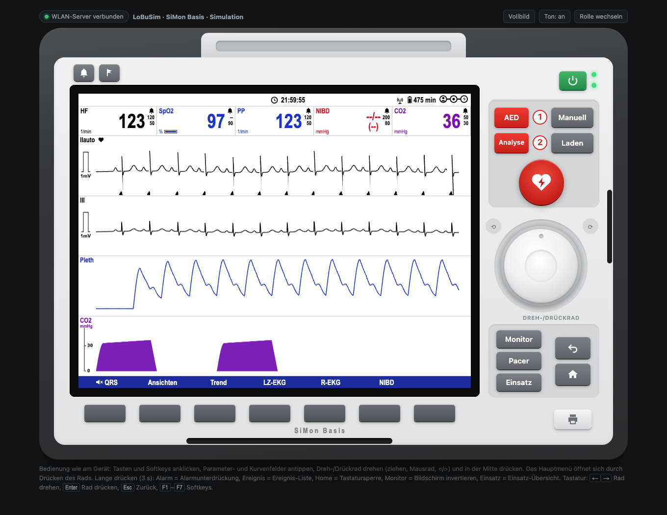SiMon Simulationsmonitor mit Vitalwerten und EKG-Kurven